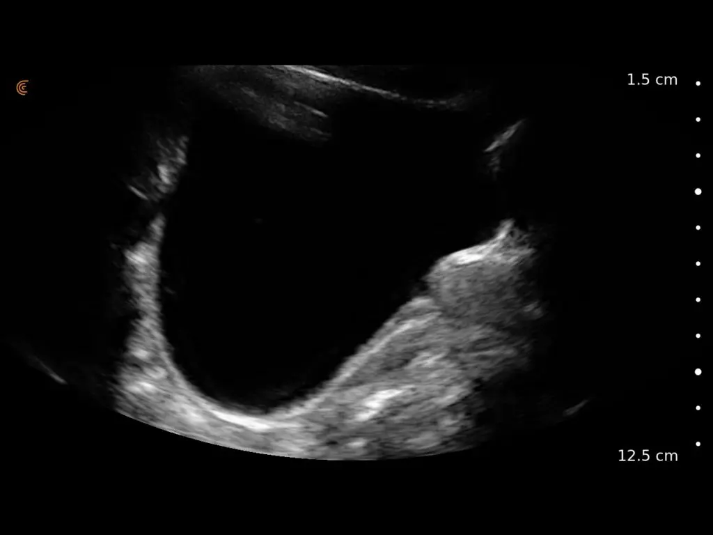 Sag-Bladder-Prostate-1024x768